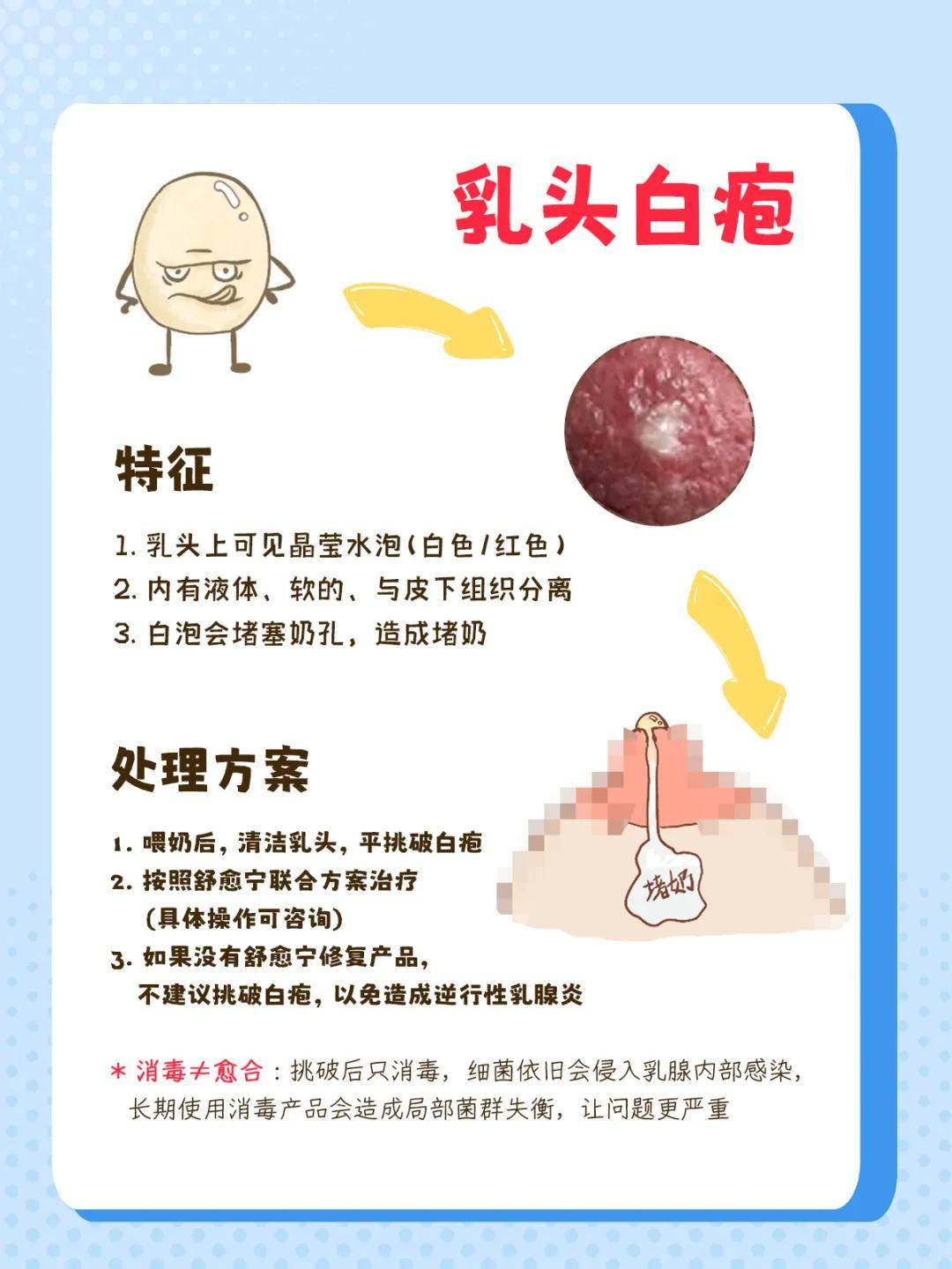 乳头小白泡,从外观上,大致可以分为4种:白疱,白栓,白溃疡,白乳头,统称
