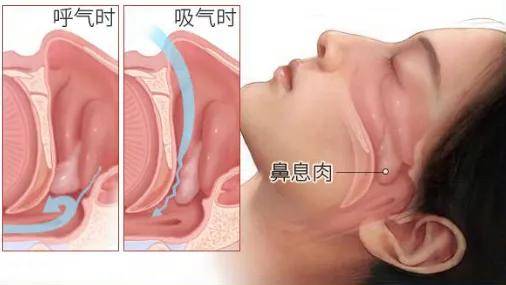 为什么鼻子会堵塞怎么解决百科在线