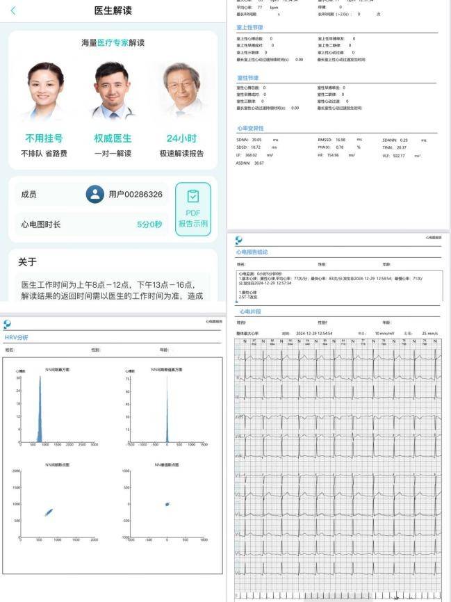 24h私人家庭健康医生:乐普lepod pro心电记录仪使用全体验