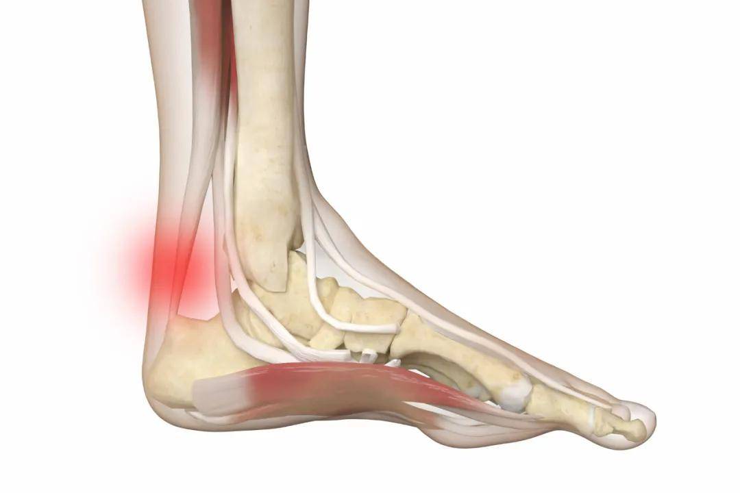 脚后跟痛,睡不安稳,立马捏捏这1处,比止痛药强