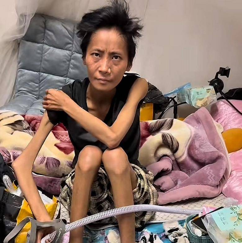 四川美女网红何国芳去世!年仅33岁,体重才58斤,生病时没人陪伴