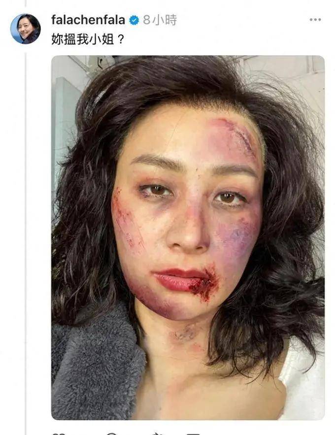 43岁陈法拉晒"毁容"照吓坏网友!