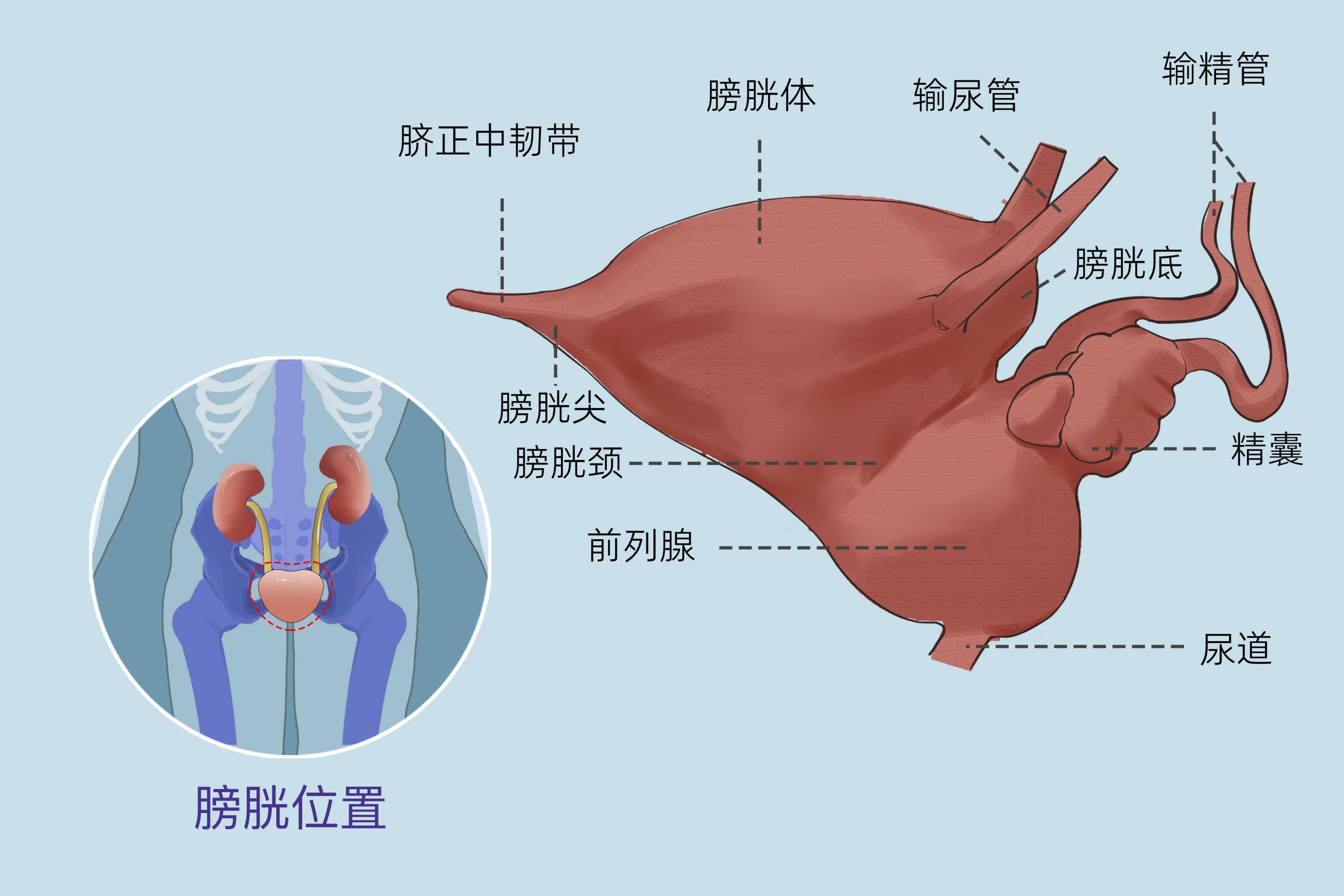 68岁男子因膀胱癌离世!提醒:小便出现这3种异常,不可疏忽大意