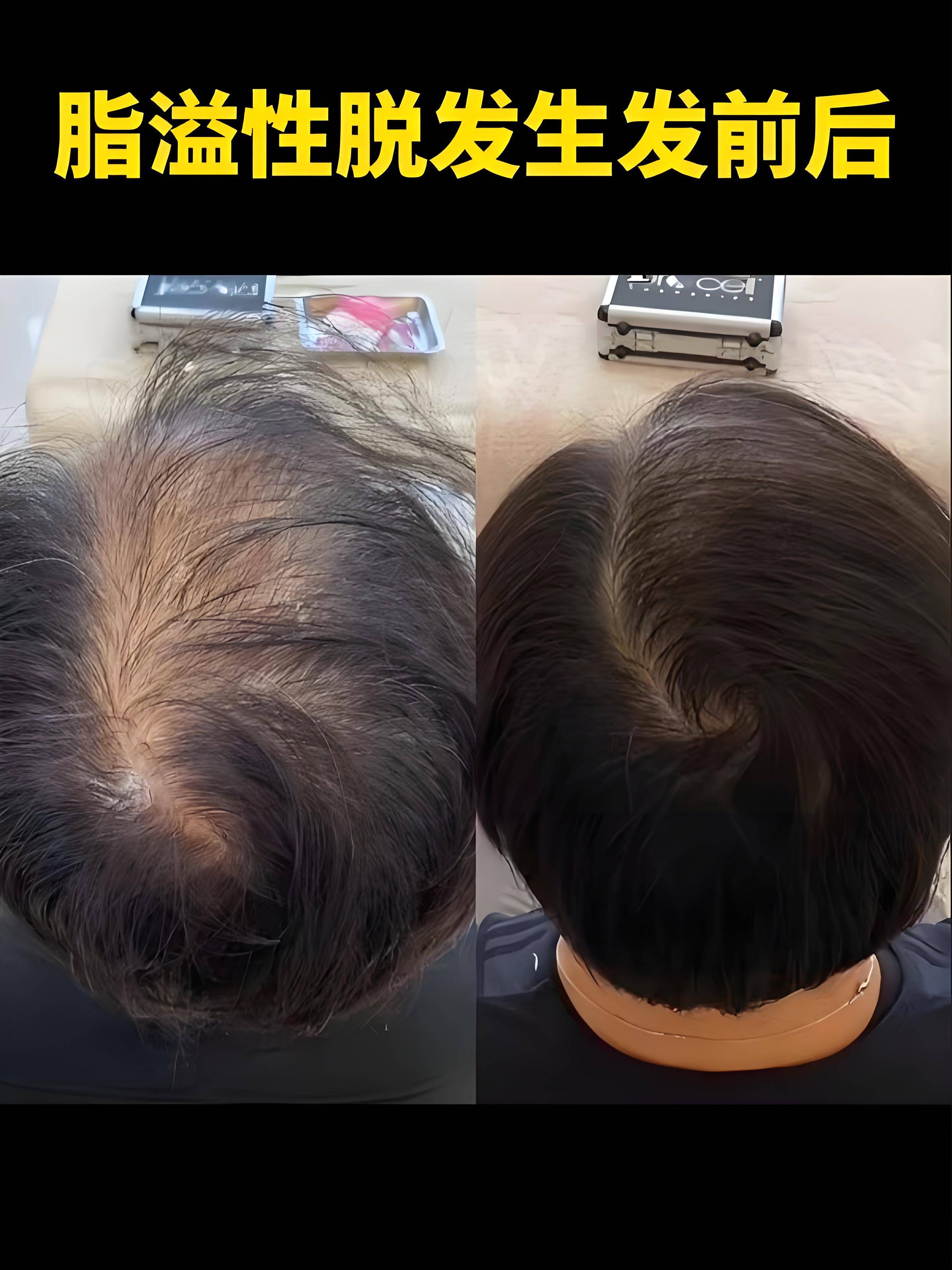 防脱发生发增发密发哪个牌子好?国内口碑前十名产品盘点请收藏