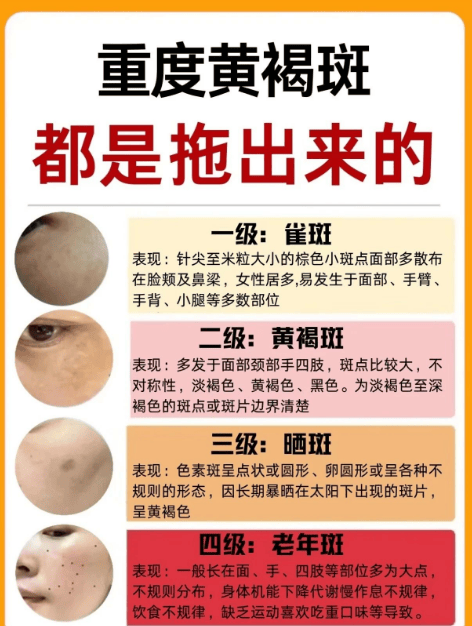 苗坊净颜祛斑效果好吗 苗坊净颜加盟费多少钱