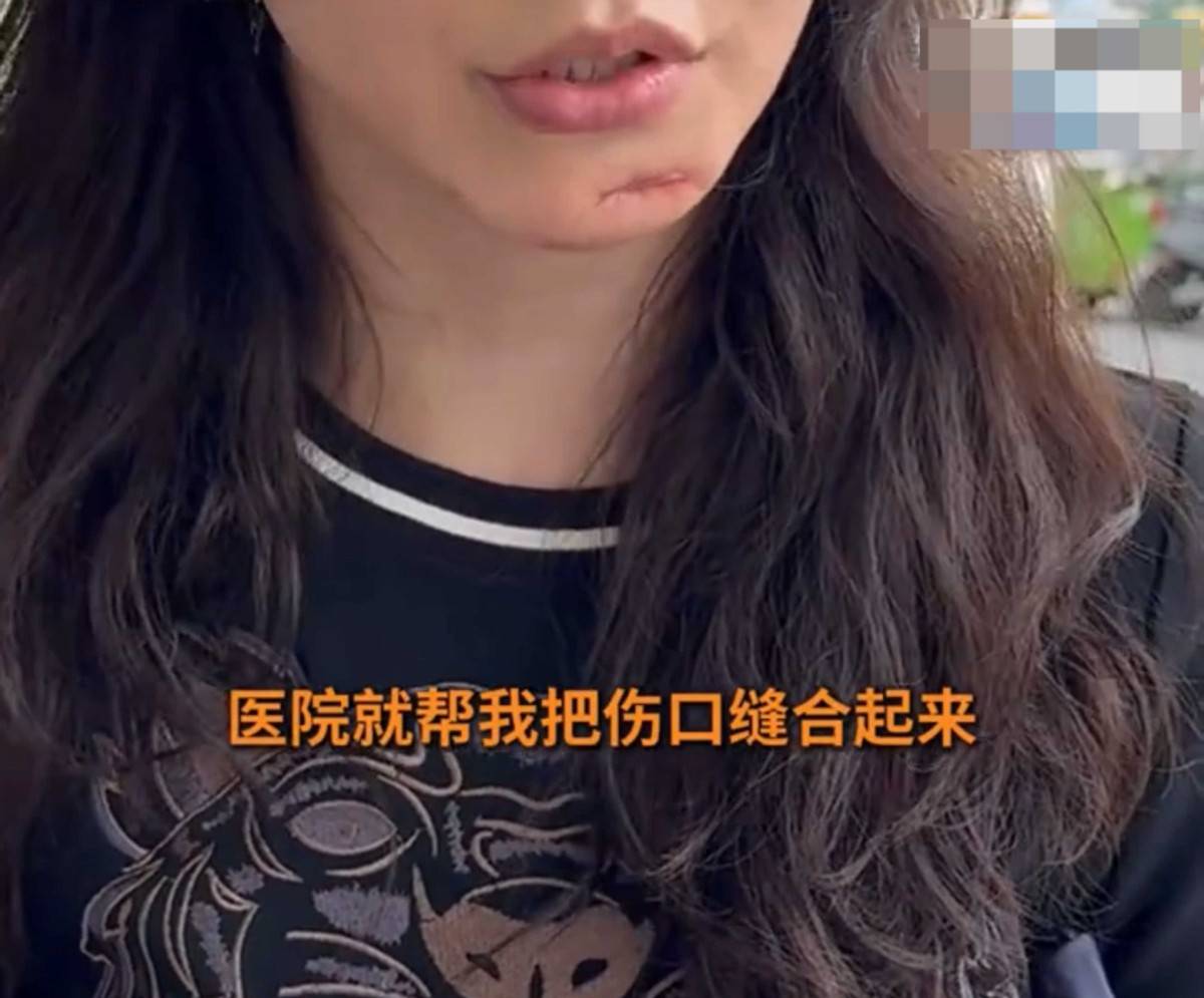 女子在徐州予美医美取生长因子烂脸 机构寄剪刀让其自行处理(图5)