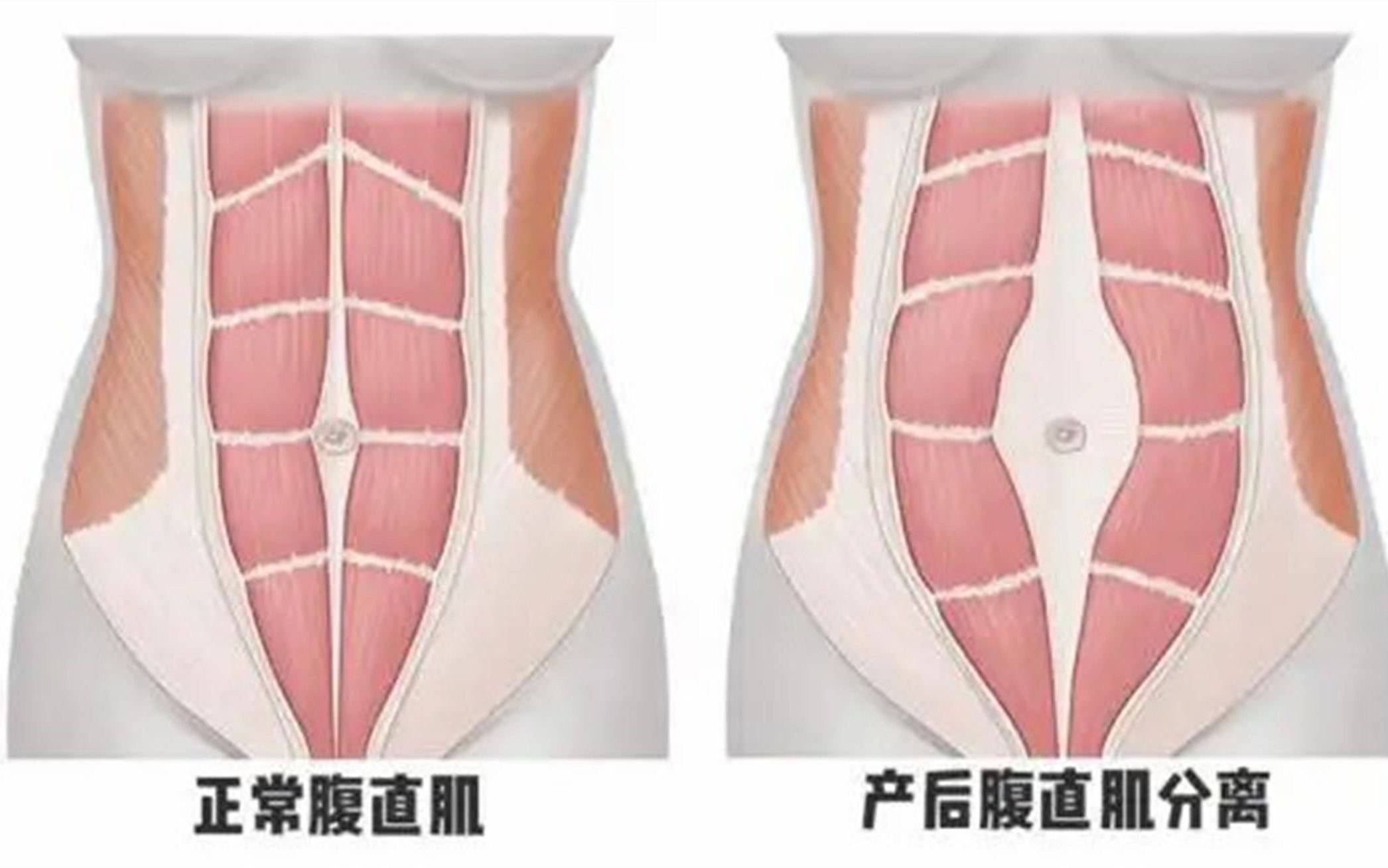 女人生完孩子体重能恢复到以前吗？产后康复师：很难