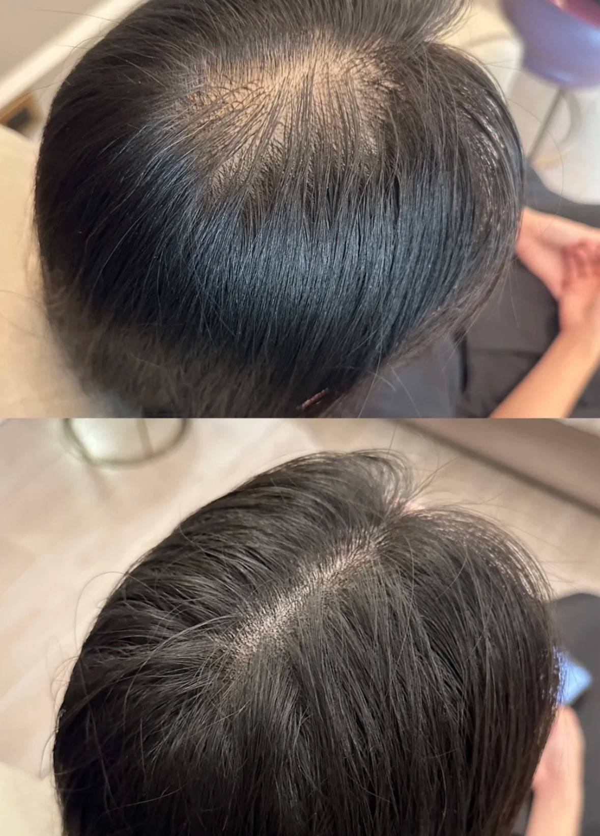用的时候注意发际线发缝重点涂抹断发掉发头皮过敏换季脱发等都适
