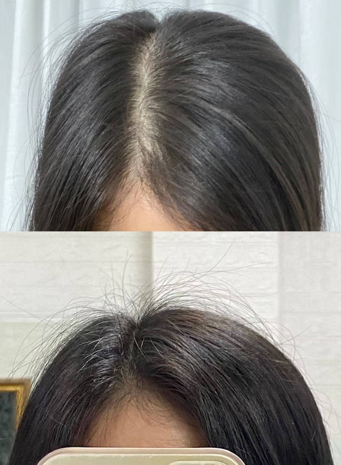生发液什么牌子好?防脱育发产品排行榜前十公布热门养发榜单