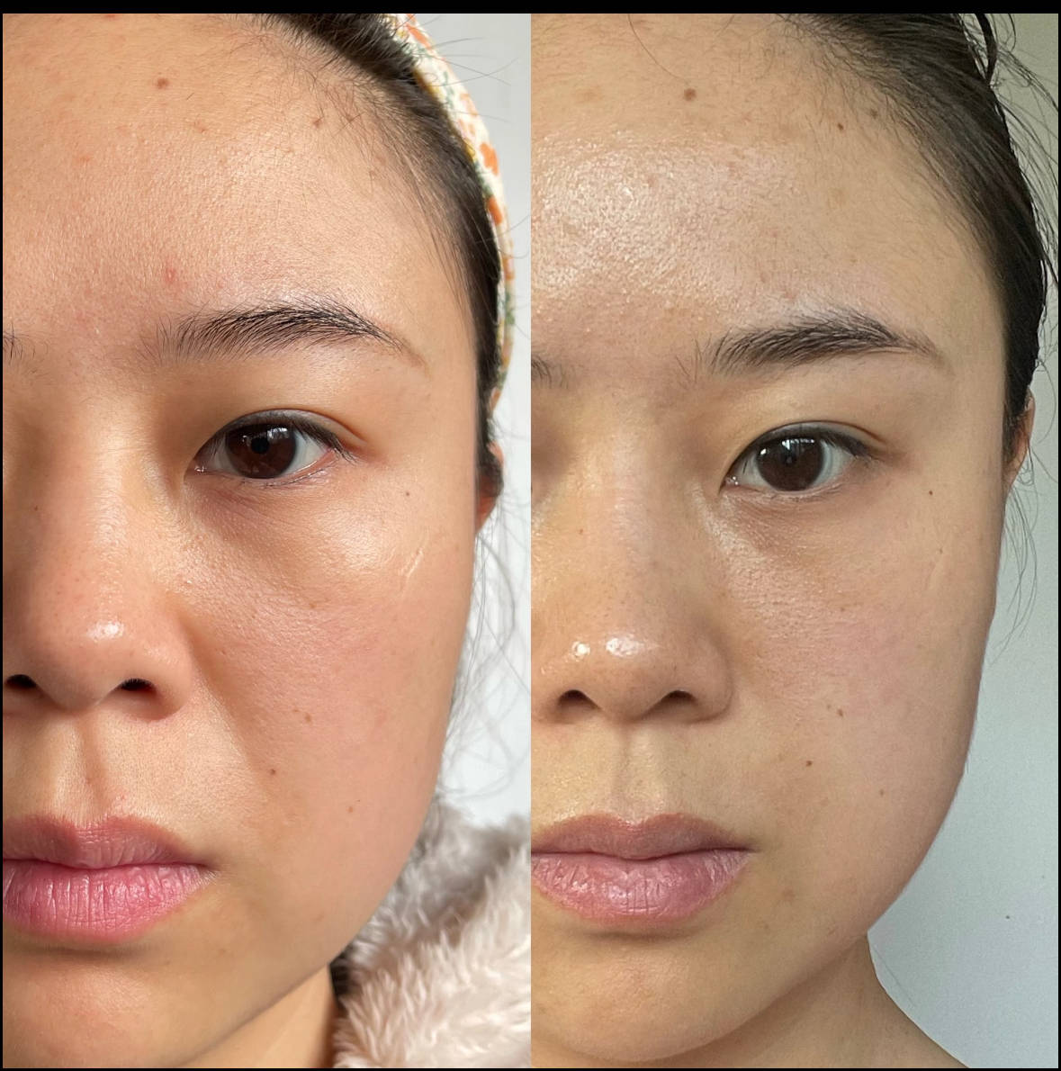 防皱抗衰老的护肤品,揭晓:抗衰老的护肤品排行榜前十名