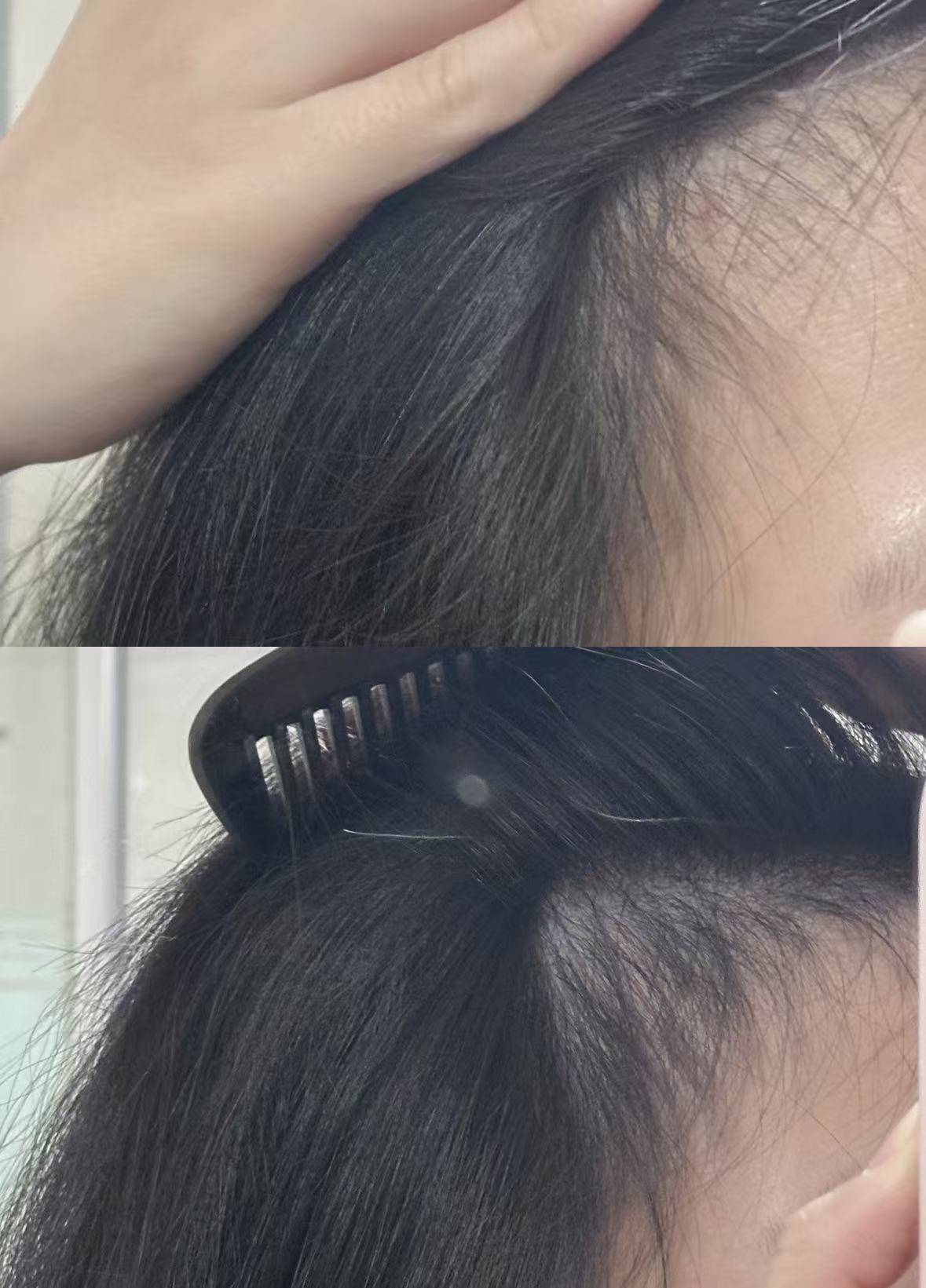 防脱育发哪个牌子最有效?国药准字号十大生发防脱产品排名专业优选