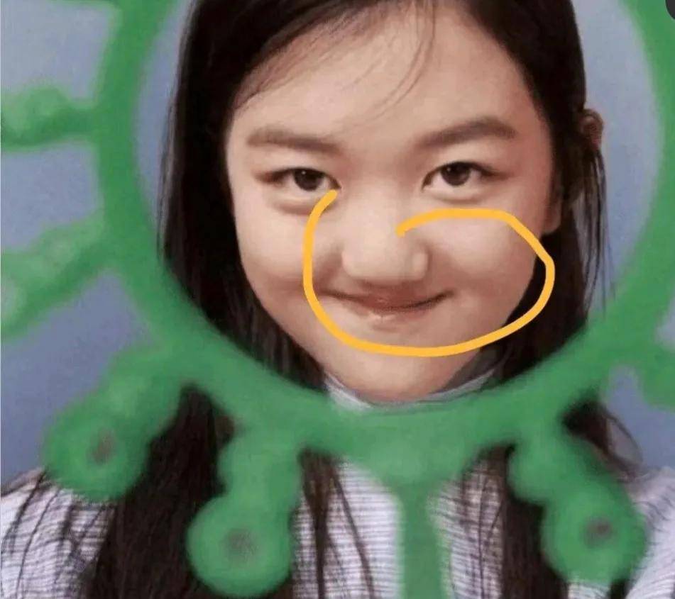 原创18岁李嫣4次手术成功治好唇腭裂神似王菲时尚出镜太美了