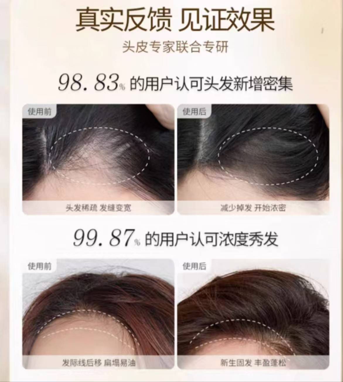 生发液哪个牌子效果好?