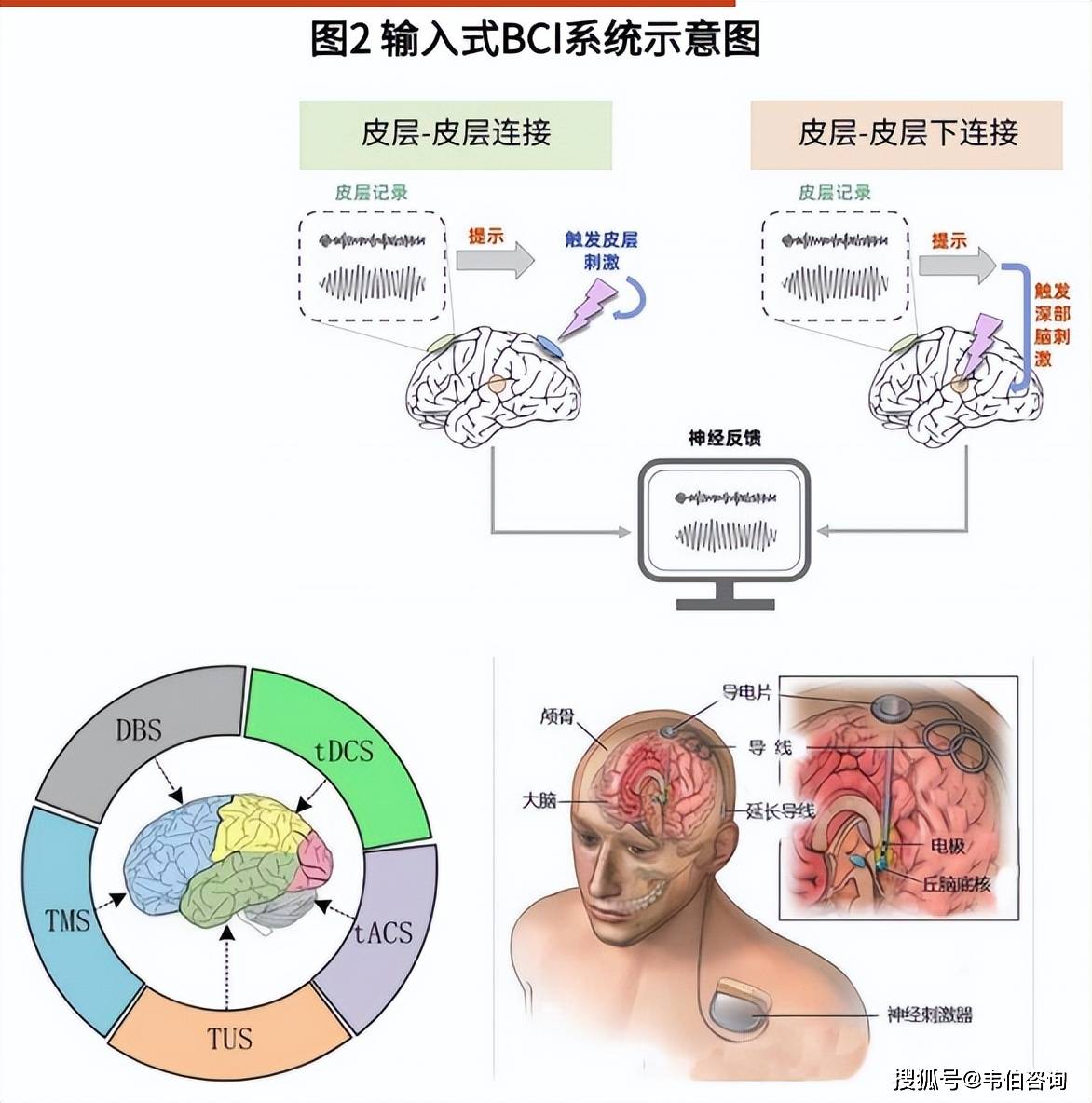 脑机接口产业明确路线图
