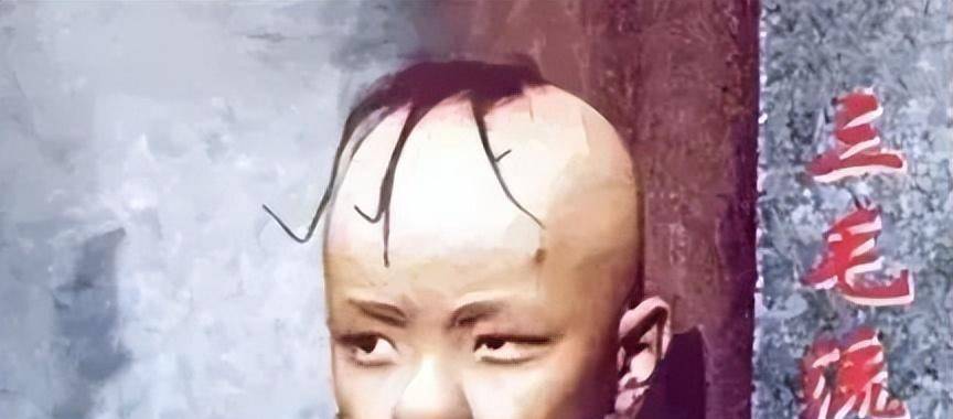 8岁演"三毛",和孙俪是同学,14岁秃顶,现在38岁容貌大变