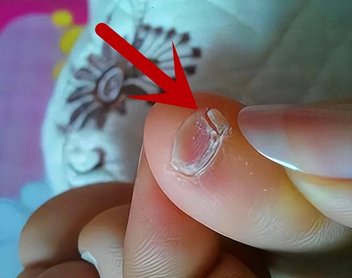 小脚趾拥有两瓣甲的人,到底是何神秘来历?是不是纯种汉人?