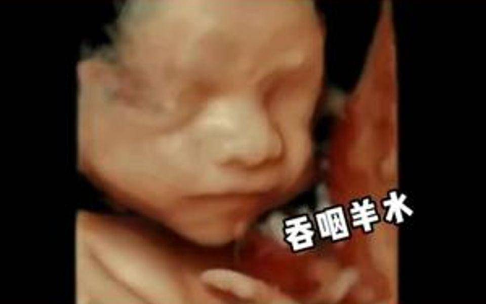 子宫里的水为什么要叫＂羊水＂, 而不是＂人水＂,或者其他的水？