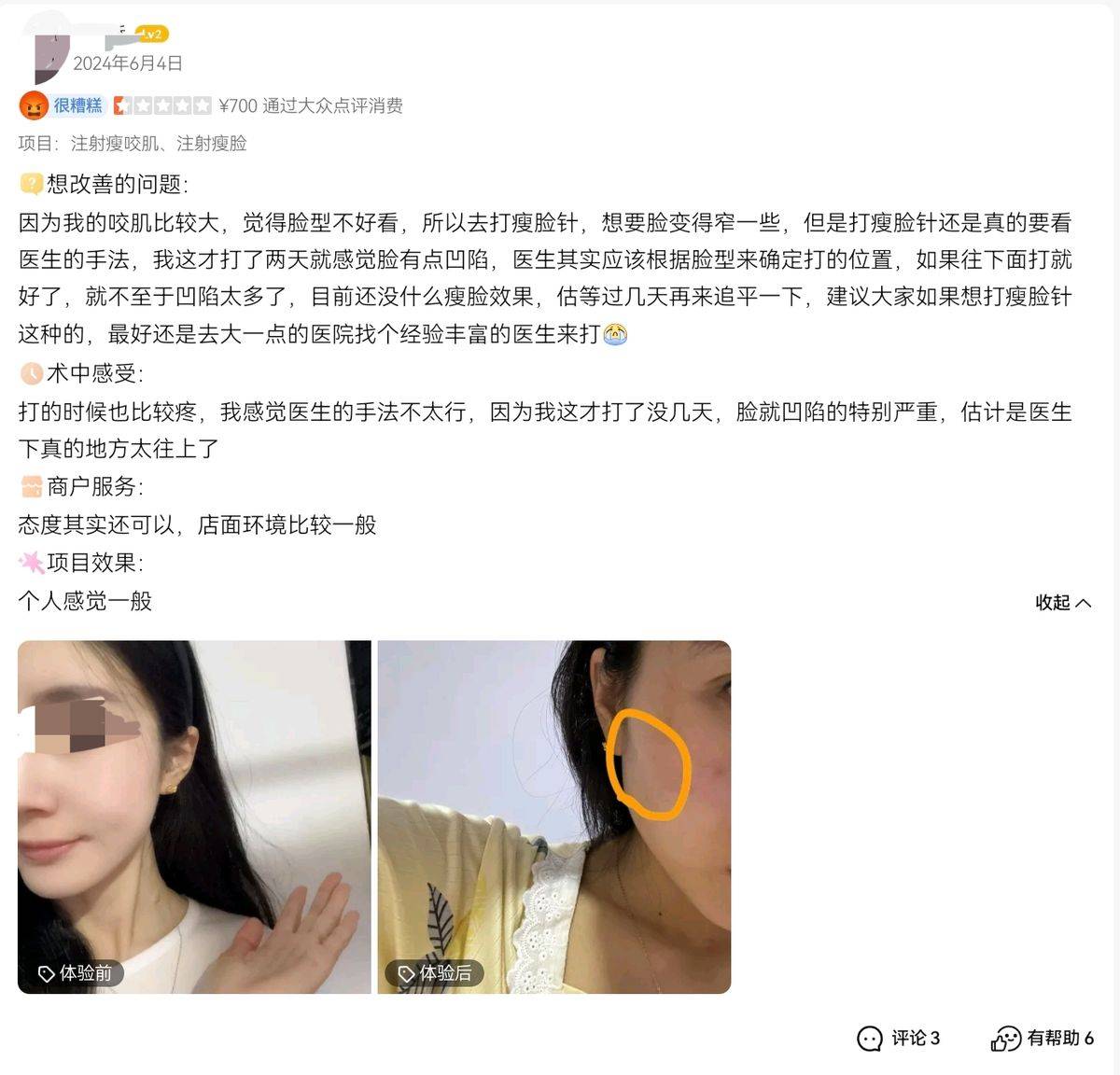 上海春藤医美被曝隆鼻手术失败:18天3次手术谁受得了?(图11)