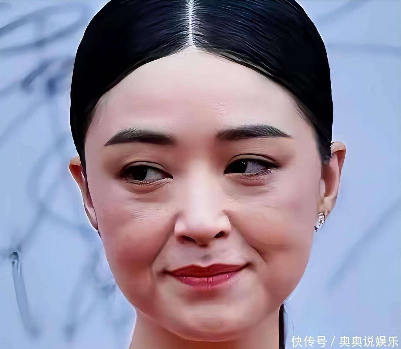 明星_细纹_皮肤