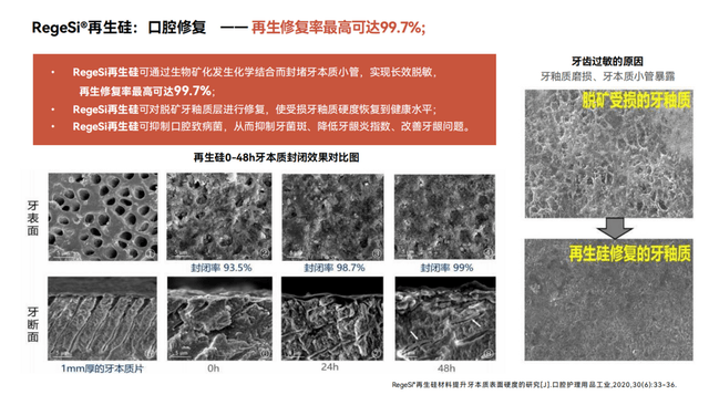 牙痛出血裂缝救星!左点再生硅牙膏用黑科技让牙齿“重生”