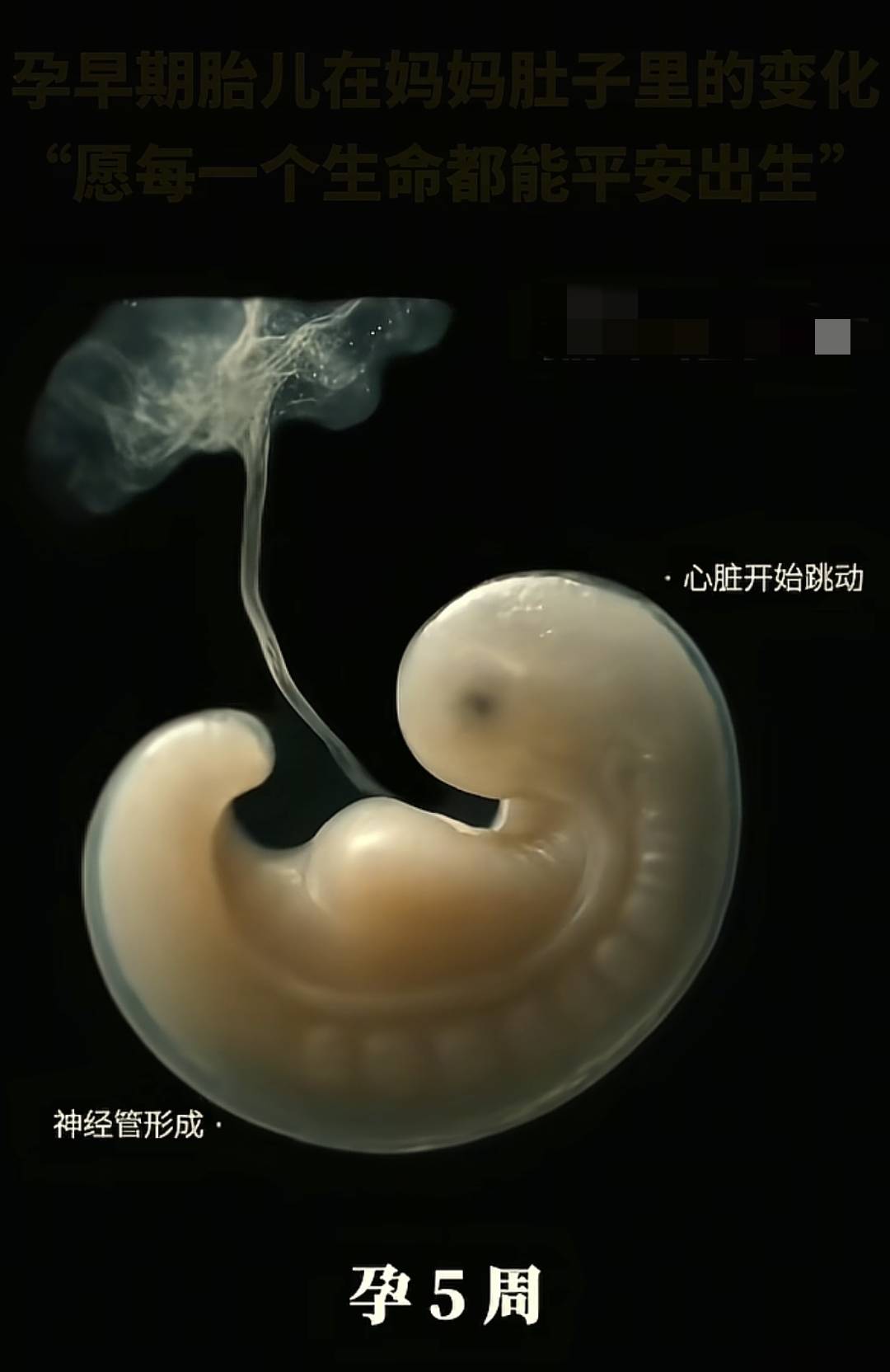 从胚胎到变成胎儿这个孕早期的过程到底是怎么样的？