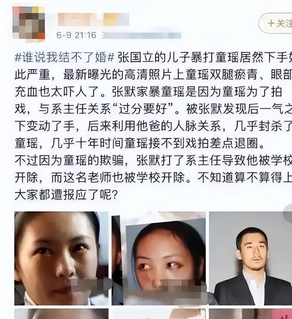 分手22年,被暴打的童瑶再次官宣喜讯,成为张默高攀不起的存在!