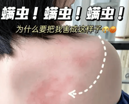 除螨仪哪家比较好?十大高品质除螨仪品牌排行榜出炉!全网独一份