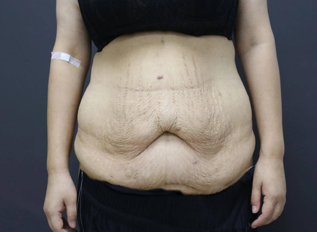 生育损伤是注定的吗?不用就医,忍一忍就好！