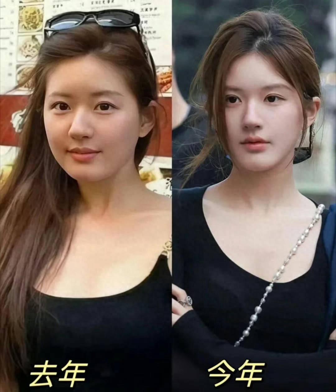 赵露思"整容风波"再升级!旧照对比判若两人,工作室紧急回应