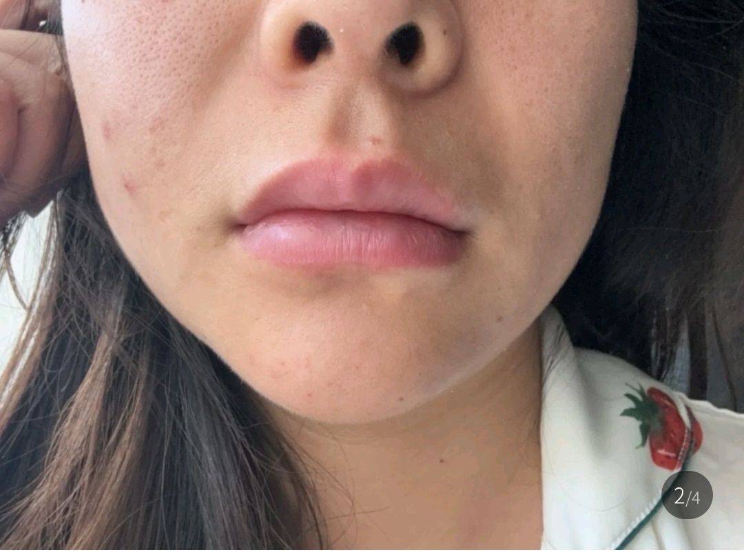 太原丽都整形被曝当面拆封:转身减量 求美者直呼被当傻子(图9)