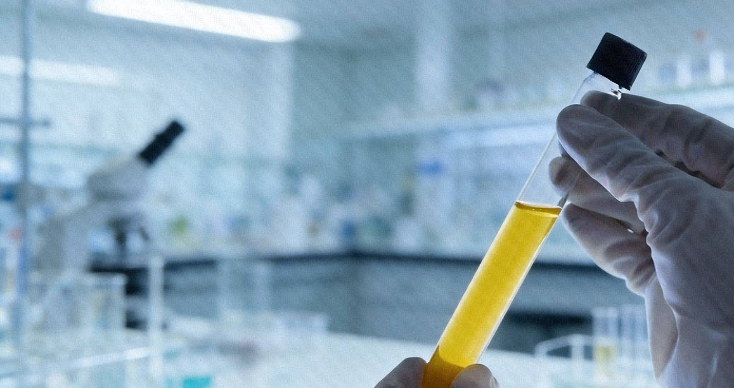 别忽视这些信号 它们可能是阿尔茨海默病悄悄来临的前兆