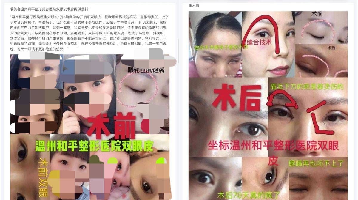 从温州和平整形医院的消费投诉:看品牌注销与重生的前世今生(图14)