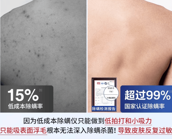 除螨仪真的有用吗还是忽悠？除螨仪哪家好怎么选择？热门家用除螨仪十大排名榜汇总揭晓