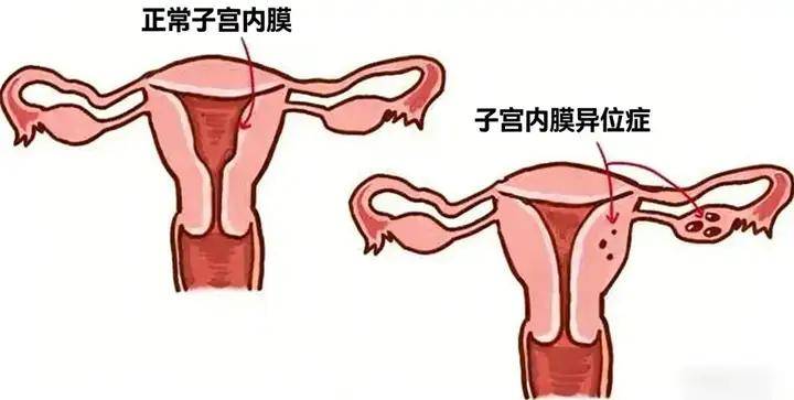 痛经也划分成7个等级？注意疼到第5个等级,赶紧就医了