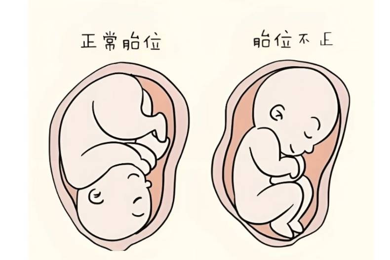 胎位什么时候定?孕妈别慌,这些周数节点和调整方法,帮你稳稳接住宝宝的第一份“见面礼”_医生_妈妈
