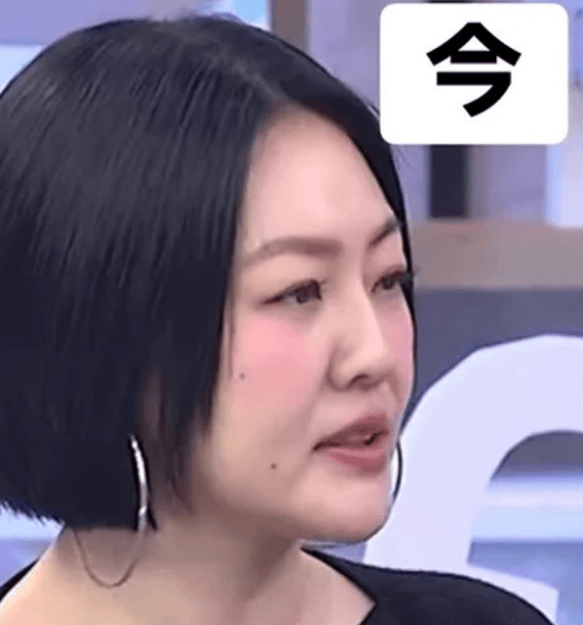 小S回归节目现两颗痣，经纪人揭秘背后原因