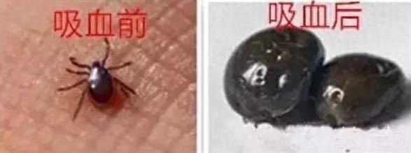 蜱虫藏“毒”！这些症状别当普通发烧