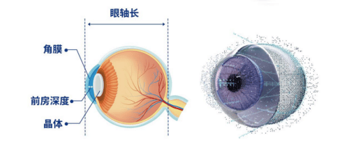 高考后摘镜 贵港爱尔全光塑技术助学子开启清晰人生(图2)