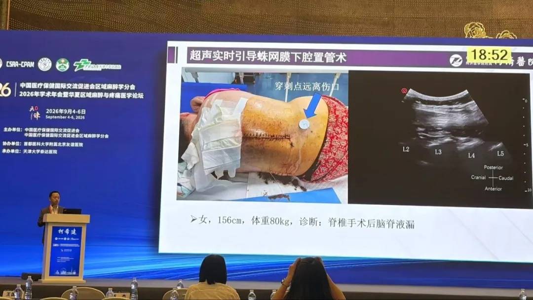文章配图-3