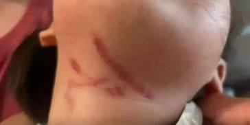 顶部图片