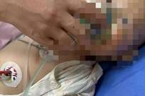 1岁宝宝吃下被邻居投毒的鸡蛋险丧命，医院3次下达病危通知书；警方在蛋壳上发现针孔，邻居自首称“想毒黄鼠狼”，不愿承担7万多元医药费
