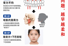 别等孩子脸变方了才后悔！这个决定颜值的关键期，很多家长都错过了