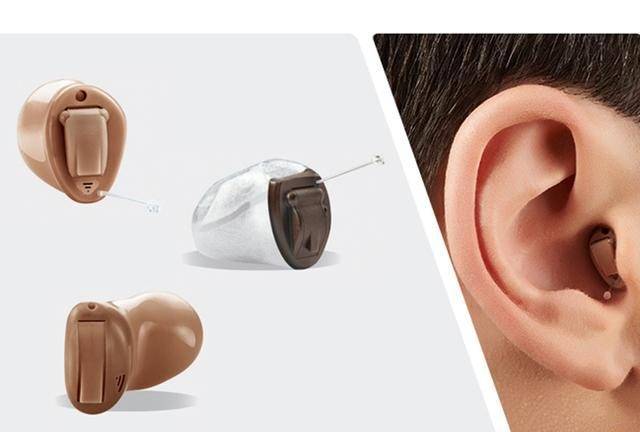 富顺惠耳(宏帆广场店)助听器科普-耳道式助听器的五大优点_声音_效果