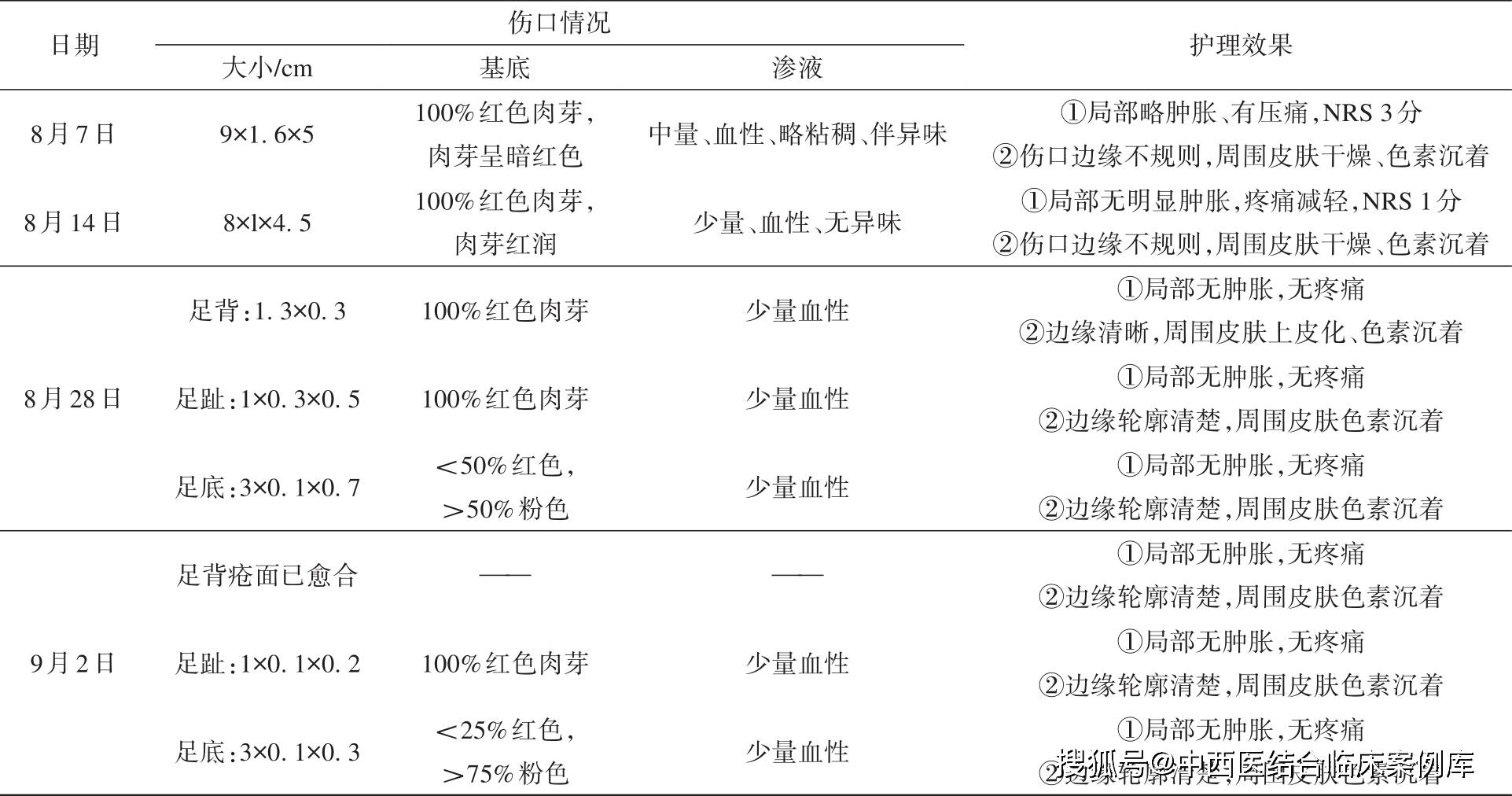 表2 效果評估4 討論糖尿病患者中有15%會出現足部潰瘍,壞疽,足部潰瘍