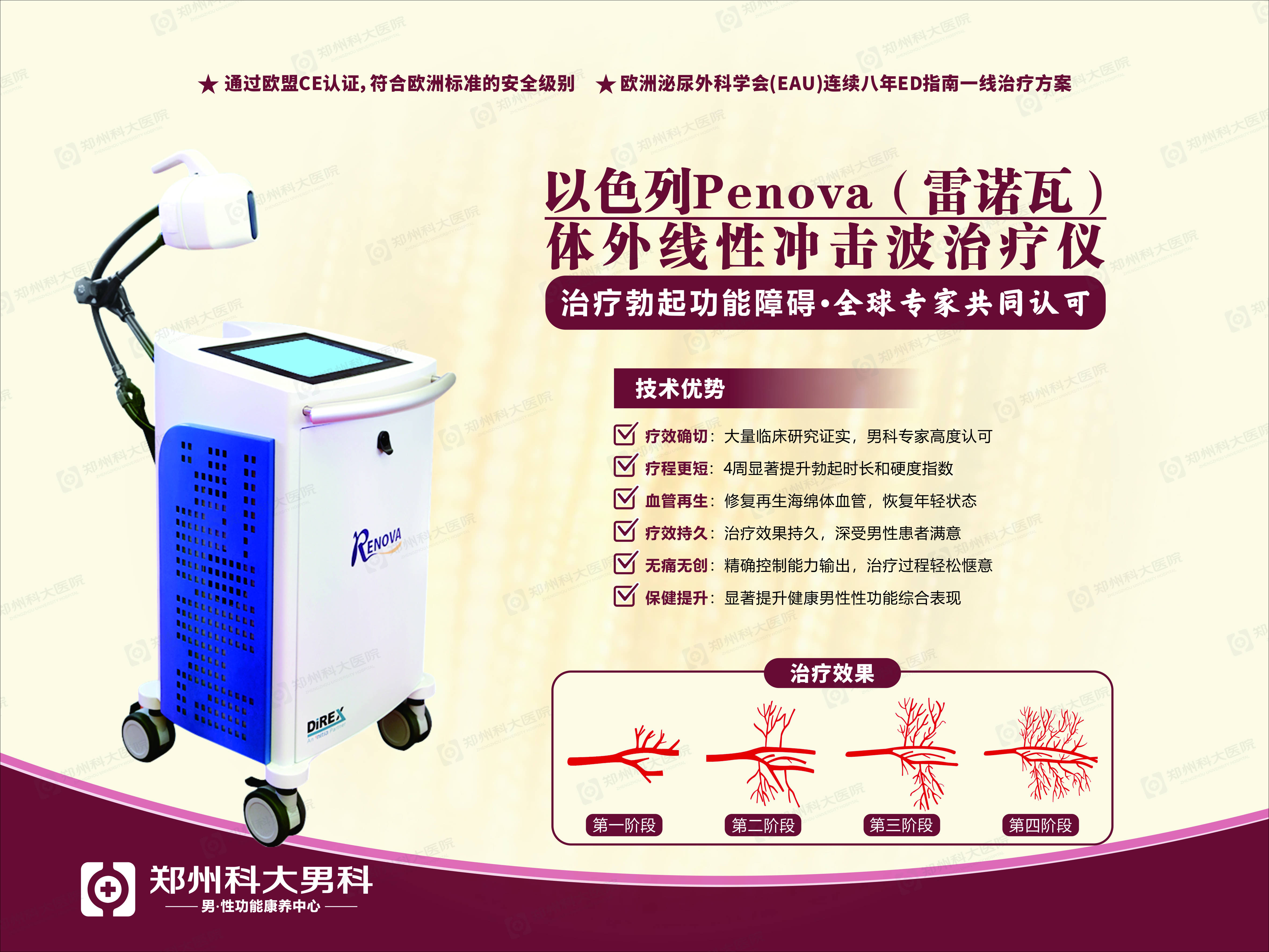 引进以色列renova(雷诺瓦)体外线性冲击波ed(男性性功能障碍)治疗仪