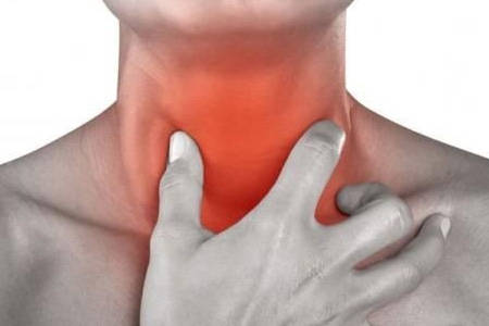 喉癌的早期症状和前兆图片