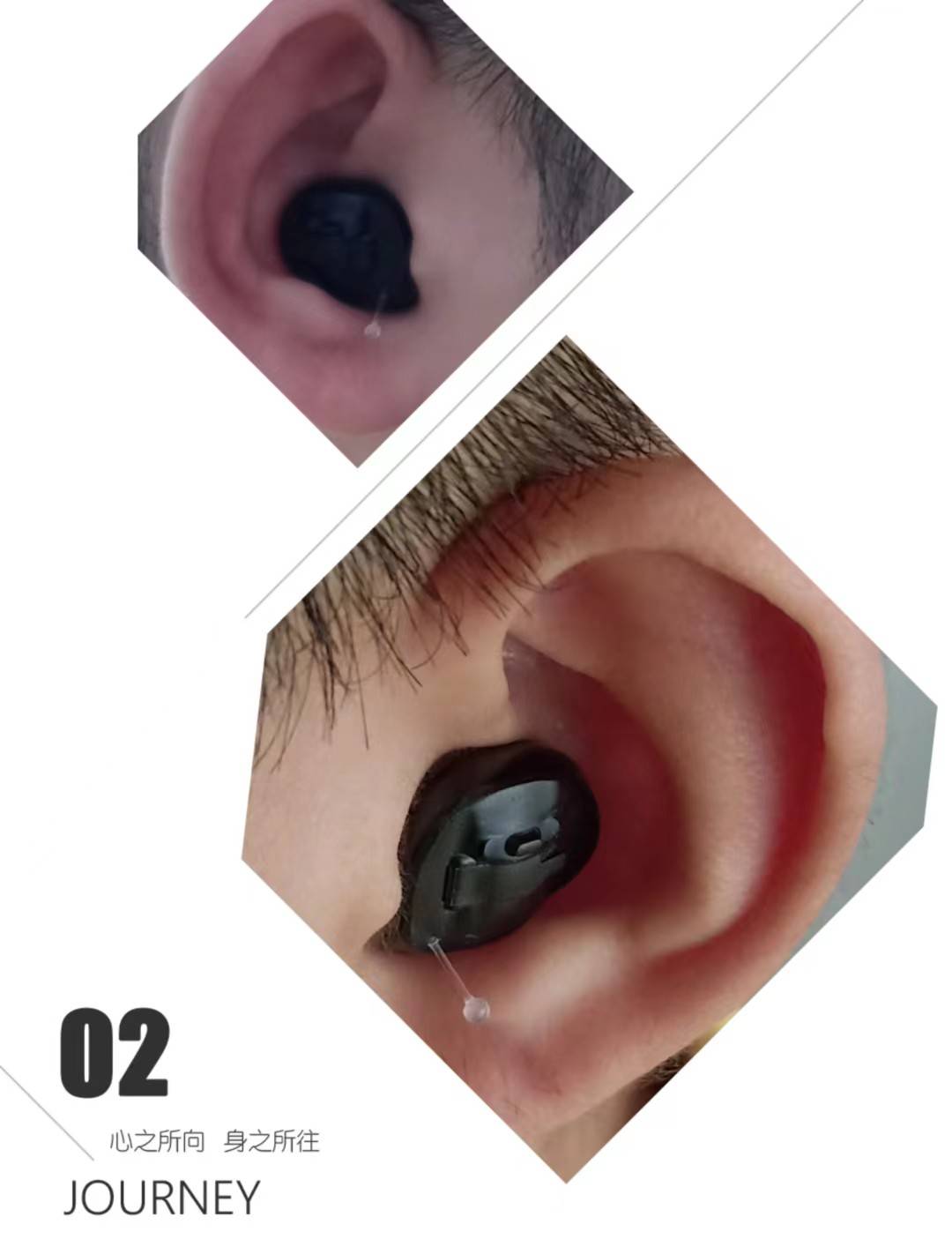 耳朵_治疗_医生