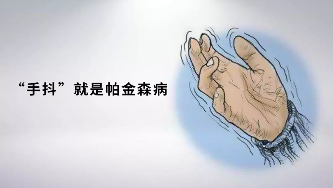 帕金森病的早期症状可能比较微妙,但也有一些常见的迹象可以帮助我们