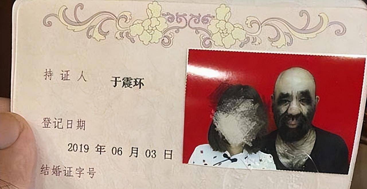 原创当年轰动一时的毛孩42岁娶90后娇妻生下一子未遗传长毛