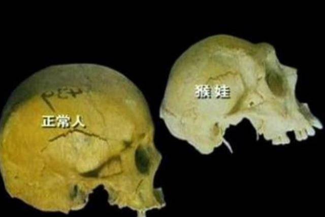 原创三峡猴娃是野人吗专家开棺检查遗骸他的六大变异如何解释